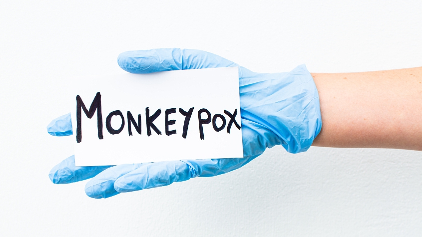 Nursing Paper Example on Monkeypox [SOLVED]